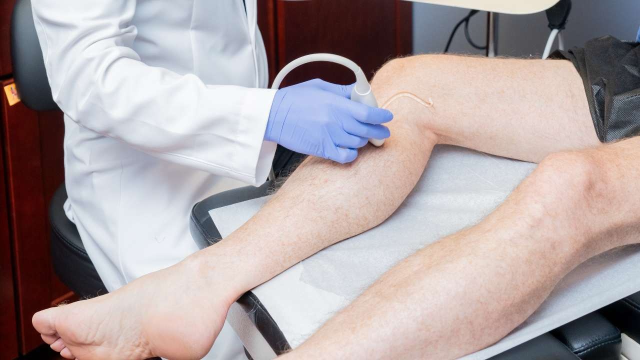 Razumijevanje bolesti proširenih vena: uzroci, simptomi i liječenje